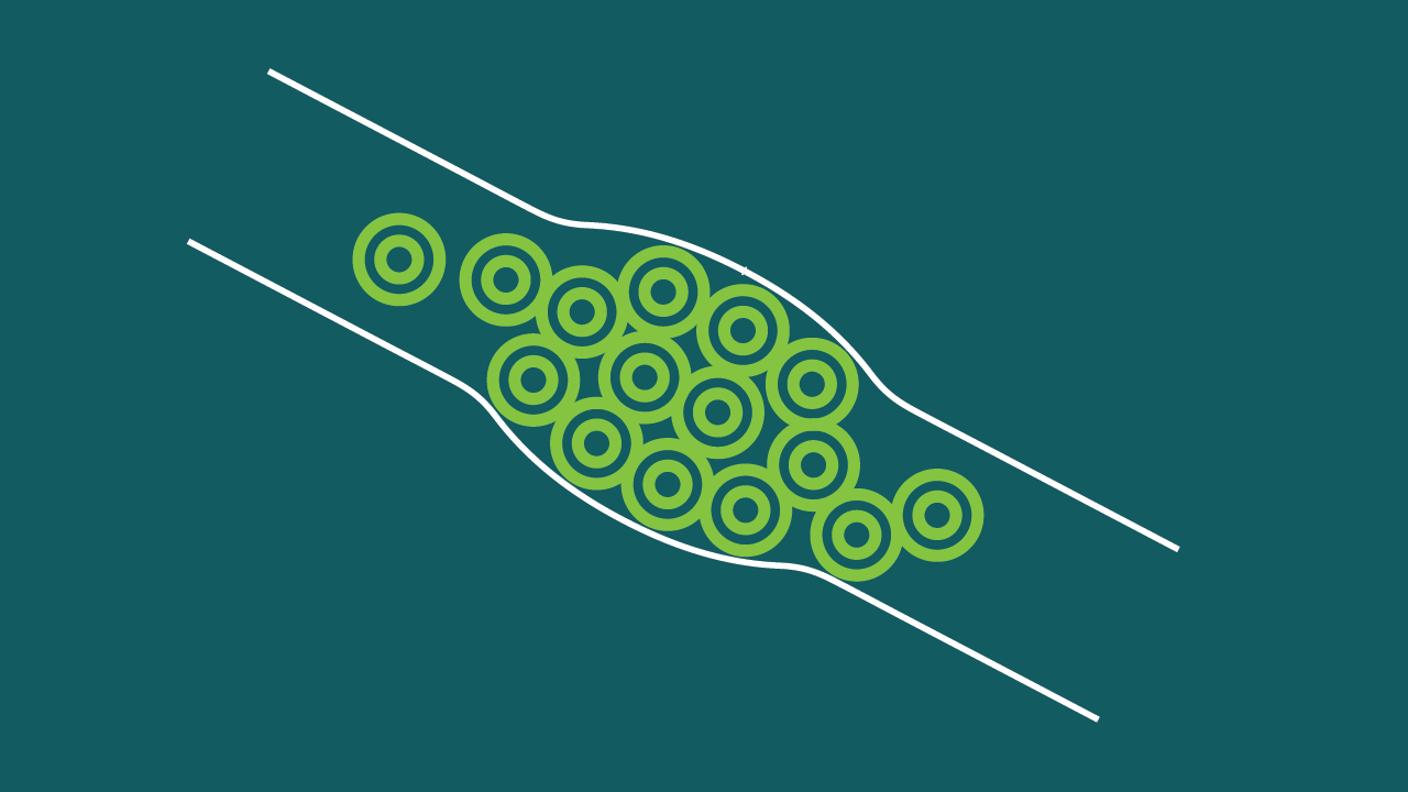Venous Thromboembolism Prevention Clinical Care Standard