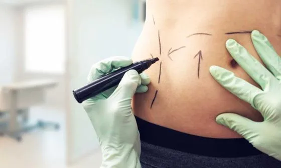 Cosmetic Surgery Campaign