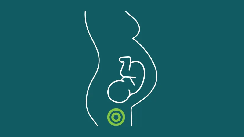 Third and Fourth Degree Perineal Tears Clinical Care Standard