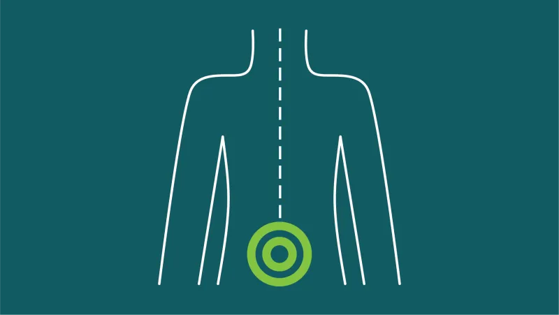 Low Back Pain Clinical Care Standard