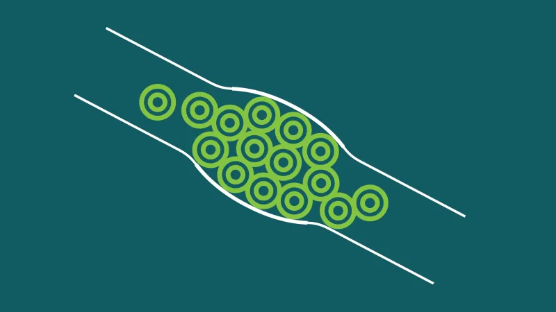 Venous Thromboembolism Prevention Clinical Care Standard