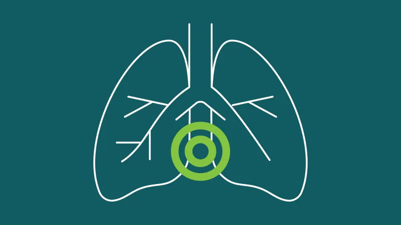 Chronic Obstructive Pulmonary Disease Clinical Care Standard