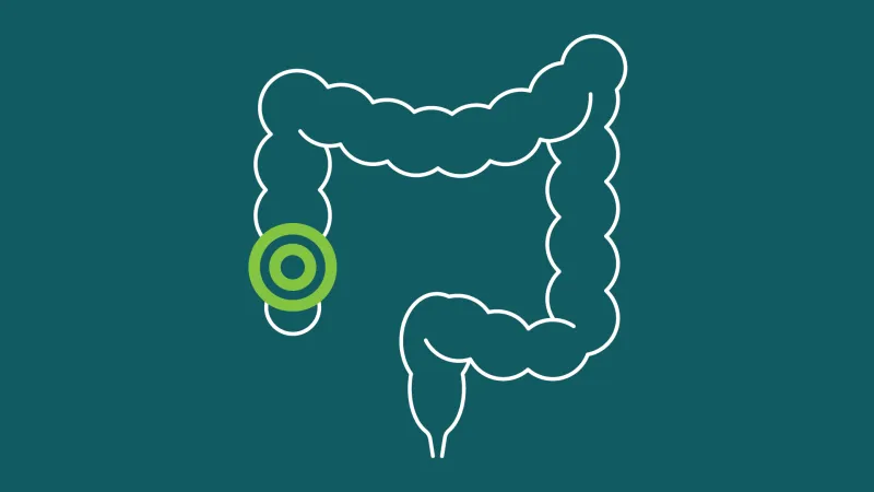 Colonoscopy Clinical Care Standard