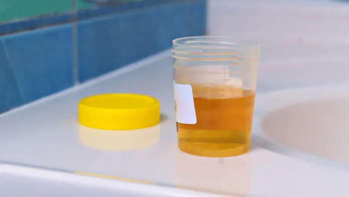 UTIs in residential aged care homes